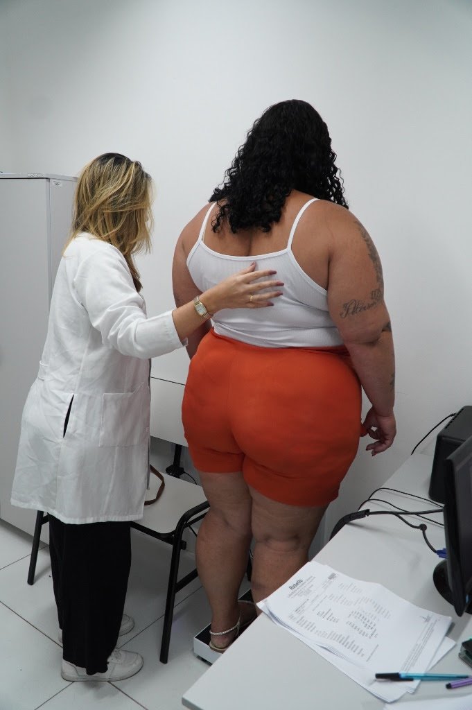 Prefeitura de São Gonçalo oferece tratamento para obesidade grave na rede municipal de Saúde