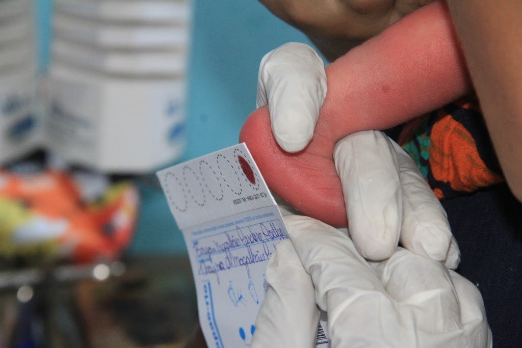 Saúde de São Gonçalo alerta para importância do teste do pezinho